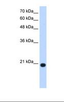 UXT Antibody - HepG2 cell lysate. Antibody concentration: 1.25 ug/ml. Gel concentration: 15%.  This image was taken for the unconjugated form of this product. Other forms have not been tested.