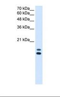 UXT Antibody - Lane A: Marker. Lane B: HepG2 cell lysate. Antibody concentration: 2.5 ug/ml. Gel concentration: 15%.  This image was taken for the unconjugated form of this product. Other forms have not been tested.
