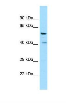 V1RL1 / VN1R1 Antibody - Western blot of Human COLO205. VN1R1 antibody dilution 1.0 ug/ml.  This image was taken for the unconjugated form of this product. Other forms have not been tested.