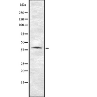 V1RL1 / VN1R1 Antibody - Western blot analysis of VN1R1 using HuvEc whole cells lysates