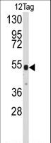 V5 Tag Antibody - Western blot of anti-V5 Tag Antibody in 12tag protein (35 ug/lane). 12 Tag (arrow) was detected using the purified antibody.