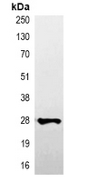 V5 Tag Antibody - Immunoprecipitation of V5-tagged protein from HEK293T cells transfected with vector overexpressing V5 tag; using Anti-V5-tag Antibody.