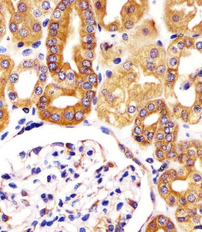 VAC14 / TRX Antibody - Antibody staining VAC14 in human kidney tissue sections by Immunohistochemistry (IHC-P - paraformaldehyde-fixed, paraffin-embedded sections). Tissue was fixed with formaldehyde and blocked with 3% BSA for 0. 5 hour at room temperature; antigen retrieval was by heat mediation with a citrate buffer (pH 6). Samples were incubated with primary antibody (1:25) for 1 hours at 37°C. A undiluted biotinylated goat polyvalent antibody was used as the secondary antibody, at a dilution of 1:25.