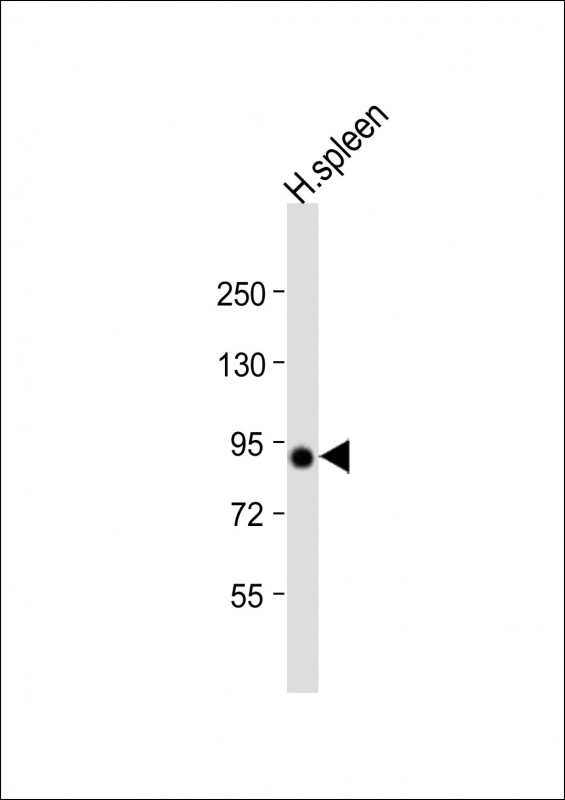 VAC14 / TRX Antibody - Anti-VAC14 Antibody (N-Term) at 1:2000 dilution + human spleen lysate Lysates/proteins at 20 ug per lane. Secondary Goat Anti-Rabbit IgG, (H+L), Peroxidase conjugated at 1:10000 dilution. Predicted band size: 88 kDa. Blocking/Dilution buffer: 5% NFDM/TBST.