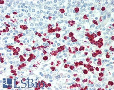 VAC14 / TRX Antibody - Human Spleen: Formalin-Fixed, Paraffin-Embedded (FFPE), at a dilution of 1:100.