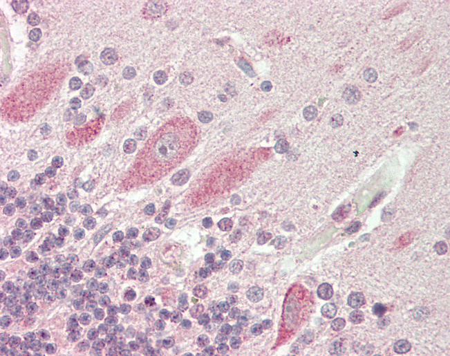VAC14 / TRX Antibody - Human Brain, Cerebellum: Formalin-Fixed, Paraffin-Embedded (FFPE).  This image was taken for the unconjugated form of this product. Other forms have not been tested.