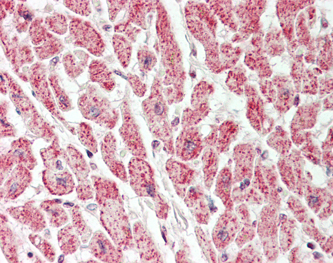 VAC14 / TRX Antibody - Human Heart: Formalin-Fixed, Paraffin-Embedded (FFPE).  This image was taken for the unconjugated form of this product. Other forms have not been tested.