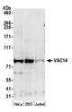 VAC14 / TRX Antibody - Detection of human VAC14 by western blot. Samples: Whole cell lysate (50 µg) from HeLa, HEK293T, and Jurkat cells prepared using NETN lysis buffer. Antibody: Affinity purified rabbit anti-VAC14 antibody used for WB at 0.1 µg/ml. Detection: Chemiluminescence with an exposure time of 3 minutes.