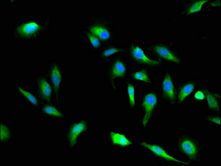 VAC14 / TRX Antibody - Immunofluorescent analysis of Hela cells using VAC14 Antibody at a dilution of 1:100 and Alexa Fluor 488-congugated AffiniPure Goat Anti-Rabbit IgG(H+L)