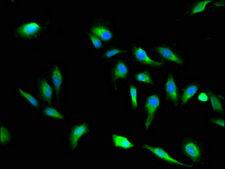 VAC14 / TRX Antibody - Immunofluorescent analysis of Hela cells using VAC14 Antibody at a dilution of 1:100 and Alexa Fluor 488-congugated AffiniPure Goat Anti-Rabbit IgG(H+L)