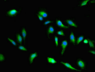 VAC14 / TRX Antibody - Immunofluorescent analysis of Hela cells using VAC14 Antibody at dilution of 1:100 and Alexa Fluor 488-congugated AffiniPure Goat Anti-Rabbit IgG(H+L)
