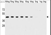 Vaccinia Virus H1L Antibody - Western blot of anti-H1L antibody (SG071115B) in recombinant pGEX-H1L protein. H1L(arrow) was detected using the purified antibody.