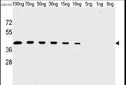 Vaccinia Virus H1L Antibody - Western blot of anti-H1L antibody (SG071115A) in recombinant H1L protein. H1L(arrow) was detected using the purified antibody.