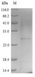 Smallpox-A27L Protein - (Tris-Glycine gel) Discontinuous SDS-PAGE (reduced) with 5% enrichment gel and 15% separation gel.