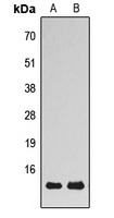 VAMP1+2+3 Antibody - Western blot analysis of VAMP1/2/3 expression in HepG2 (A); mouse brain (B) whole cell lysates.