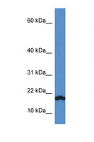 VAMP1 / VAMP-1 Antibody - VAMP1 antibody Western blot of Rat Lung lysate. Antibody concentration 1 ug/ml.  This image was taken for the unconjugated form of this product. Other forms have not been tested.