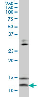 VAMP1 / VAMP-1 Antibody - VAMP1 monoclonal antibody (M02), clone 5A4 Western blot of VAMP1 expression in HepG2.
