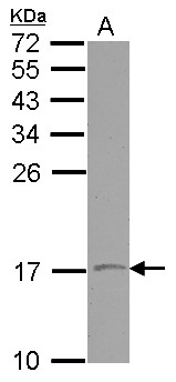 VAMP1 / VAMP-1 Antibody - Sample (30 ug of whole cell lysate) A: NT2D1 15% SDS PAGE VAMP1 antibody diluted at 1:500