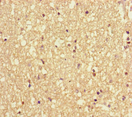 VAMP1 / VAMP-1 Antibody - Immunohistochemistry of paraffin-embedded human brain tissue using VAMP1 Antibody at dilution of 1:100