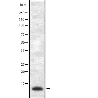 VAMP1 / VAMP-1 Antibody - Western blot analysis of VAMP-1/2/3 using Jurkat whole cells lysates