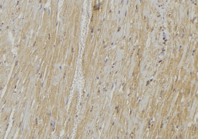 VAMP1 / VAMP-1 Antibody - 1:100 staining mouse muscle tissue by IHC-P. The sample was formaldehyde fixed and a heat mediated antigen retrieval step in citrate buffer was performed. The sample was then blocked and incubated with the antibody for 1.5 hours at 22°C. An HRP conjugated goat anti-rabbit antibody was used as the secondary.
