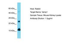 VAMP1 / VAMP-1 Antibody -  This image was taken for the unconjugated form of this product. Other forms have not been tested.