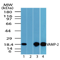 VAMP2 / VAMP-2 Antibody - Western blot of VAMP-2 in mouse embryo brain lysate in the 1) absence and 2) presence of immunizing peptide (1 ug/ml), 3) mouse brain (1 ug/ml) and 4) rat brain lysate (2 ug/ml) using Polyclonal Antibody to VAMP-2.