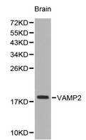 VAMP2 / VAMP-2 Antibody - Western blot of VAMP2 pAb in extracts from mouse brain tissue.