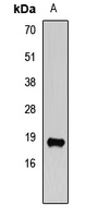 VAMP2 / VAMP-2 Antibody