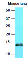VAMP3 / VAMP-3 Antibody - The extracts of mouse lung tissue (40 ug) were resolved by SDS-PAGE, transferred to NC membrane and probed with anti-human Cellubrevin (1:1000). Proteins were visualized using a goat anti-mouse secondary antibody conjugated to HRP and an ECL detection system.