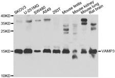 VAMP3 / VAMP-3 Antibody - Western blot analysis of extracts of various cell lines.