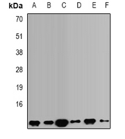VAMP3 / VAMP-3 Antibody - Western blot analysis of VAMP3 expression in SKOV3 (A); A549 (B); mouse testis (C); mouse kidney (D); rat lung (E); rat brain (F) whole cell lysates.