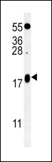 VAMP4 / VAMP-4 Antibody - VAMP4 Antibody western blot of K562 cell line lysates (35 ug/lane). The VAMP4 antibody detected the VAMP4 protein (arrow).