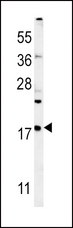 VAMP4 / VAMP-4 Antibody - VAMP4 Antibody western blot of mouse liver tissue lysates (35 ug/lane). The VAMP4 antibody detected the VAMP4 protein (arrow).