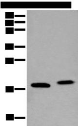 VAMP4 / VAMP-4 Antibody - Western blot analysis of K562 cell and Mouse brain tissue lysates  using VAMP4 Polyclonal Antibody at dilution of 1:400