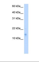 VAMP5 / VAMP-5 Antibody - Fetal lung cell lysate. Antibody concentration: 5.0 ug/ml. Gel concentration: 15%.  This image was taken for the unconjugated form of this product. Other forms have not been tested.