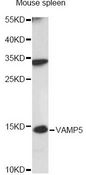 VAMP5 / VAMP-5 Antibody - Western blot analysis of extracts of mouse spleen, using VAMP5 antibody at 1:3000 dilution. The secondary antibody used was an HRP Goat Anti-Rabbit IgG (H+L) at 1:10000 dilution. Lysates were loaded 25ug per lane and 3% nonfat dry milk in TBST was used for blocking. An ECL Kit was used for detection and the exposure time was 90s.