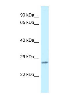 VAMP7 / SYBL1 / T1 VAMP Antibody - VAMP7 / SYBL1 antibody western blot of Mouse Liver lysate. Antibody concentration 1 ug/ml.  This image was taken for the unconjugated form of this product. Other forms have not been tested.