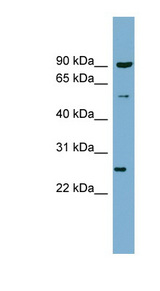VAMP7 / SYBL1 / T1 VAMP Antibody - VAMP7 / SYBL1 antibody Western blot of COLO205 cell lysate. This image was taken for the unconjugated form of this product. Other forms have not been tested.