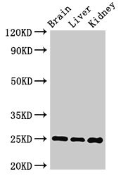 VAMP7 / SYBL1 / T1 VAMP Antibody - Western Blot Positive WB detected in: mouse brain tissue, Mouse liver tissue, Mouse kidney tissue All lanes: VAMP7 antibody at 2µg/ml Secondary Goat polyclonal to rabbit IgG at 1/50000 dilution Predicted band size: 25 kDa Observed band size: 25 kDa