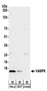 VAMP8 / VAMP-8 Antibody - Detection of Human VAMP8 by Western Blot. Samples: Whole cell lysate (50 ug) from HeLa, 293T, and Jurkat cells. Antibodies: Affinity purified rabbit anti-VAMP8 antibody used for WB at 0.4 ug/ml. Detection: Chemiluminescence with an exposure time of 3 minutes.
