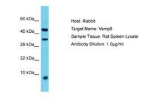 VAMP8 / VAMP-8 Antibody -  This image was taken for the unconjugated form of this product. Other forms have not been tested.