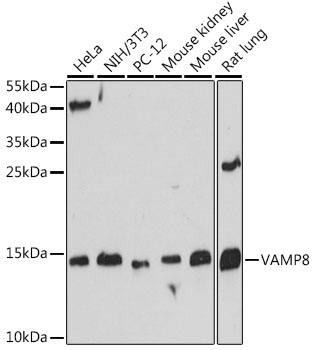 VAMP8 / VAMP-8 Antibody - Western blot analysis of extracts of various cell lines, using VAMP8 antibody at 1:500 dilution. The secondary antibody used was an HRP Goat Anti-Rabbit IgG (H+L) at 1:10000 dilution. Lysates were loaded 25ug per lane and 3% nonfat dry milk in TBST was used for blocking. An ECL Kit was used for detection and the exposure time was 60s.