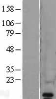 VAMP8 / VAMP-8 Protein - Western validation with an anti-DDK antibody * L: Control HEK293 lysate R: Over-expression lysate