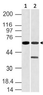 VANGL1 Antibody - Fig-1: Western blot analysis of Vang like-1. Anti-Vang like-1 antibody was used at 4 µg/ml on (1) Jurkat and (2) Liver lysates.