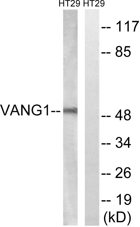 VANGL1 Antibody - Western blot analysis of lysates from HT-29 cells, using VANGL1 Antibody. The lane on the right is blocked with the synthesized peptide.