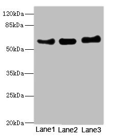 VANGL1 Antibody - Western blot All Lanes: VANGL1 antibody at 3.38ug/ml Lane 1: PC-3 whole cell lysate Lane 2: MCF7 whole cell lysate Lane 3: Hela whole cell lysate Secondary Goat polyclonal to Rabbit IgG at 1/10000 dilution Predicted band size: 60 kDa Observed band size: 60 kDa