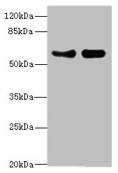 VANGL1 Antibody - Western blot All lanes: VANGL1 antibody at 3.38µg/ml Lane 1: PC-3 whole cell lysate Lane 2: Hela whole cell lysate Secondary Goat polyclonal to rabbit IgG at 1/10000 dilution Predicted band size: 60 kDa Observed band size: 60 kDa