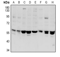 VANGL1 Antibody - Western blot analysis of VANGL1 expression in PC12 (A), CT26 (B), MCF7 (C), A549 (D), SKOVCAR3 (E), A2780 (F), mouse testis (G), rat testis (H) whole cell lysates.