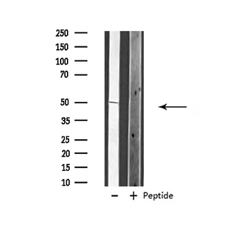 VANGL1 Antibody - Western blot analysis of extracts of HT29 cells using VANGL1 antibody.